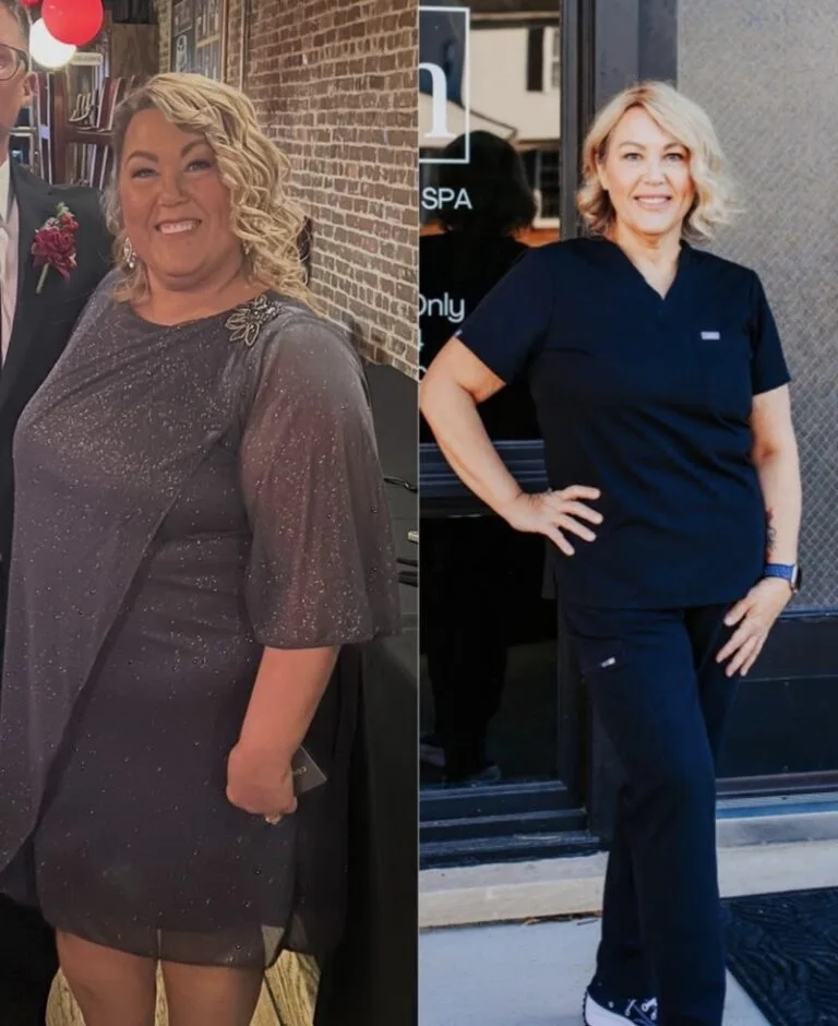 Weight Loss