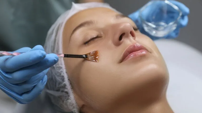 Peels