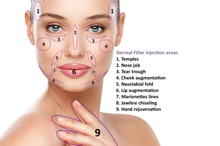 Fillers